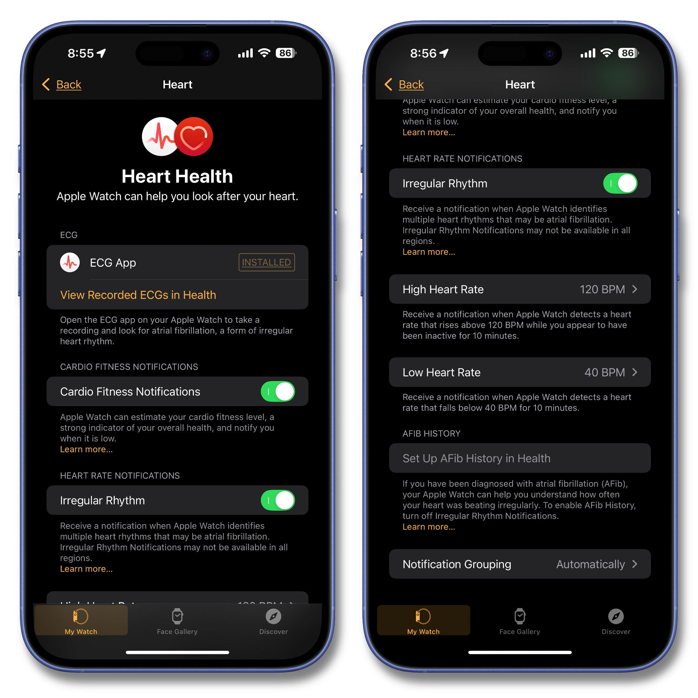 Apple Watch Heart settings